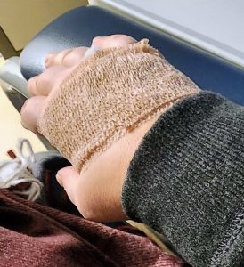 A person's wrist wearing a beige medical wrist brace, resting on a blue armrest, with a reddish-brown blanket draped over their lap.