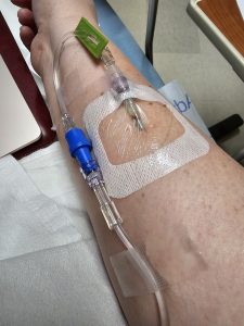 Close-up of a person's arm with an IV catheter taped to the skin, a testament to their journey through chemo. The catheter connects to a tube with a blue connector, all secured with clear medical tape. A computer is partially visible in the background, quietly monitoring vital signs.