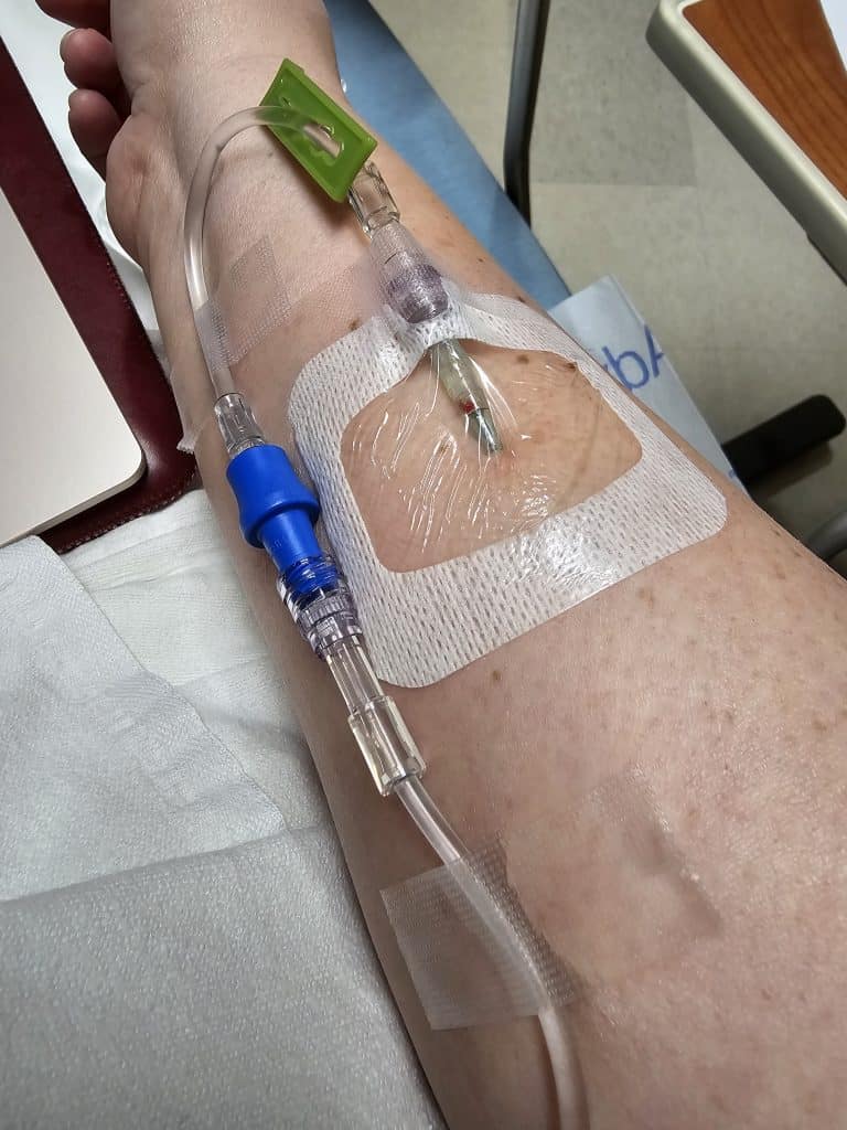 Close-up of a person's arm with an IV catheter taped to the skin, a testament to their journey through chemo. The catheter connects to a tube with a blue connector, all secured with clear medical tape. A computer is partially visible in the background, quietly monitoring vital signs.